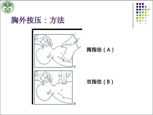胸外按压频率 胸外科是看什么病的