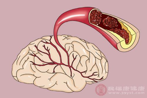 disease是什么意思 diseases怎么读