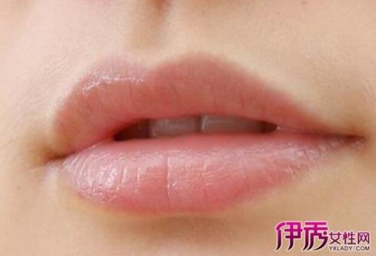 上火嘴上起泡怎么办呢 上火吃什么可以降火